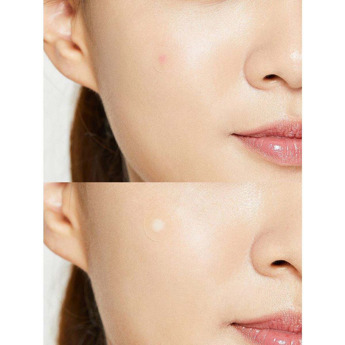 Cosrx Acne Pimple Master Patch - 24 Pieces