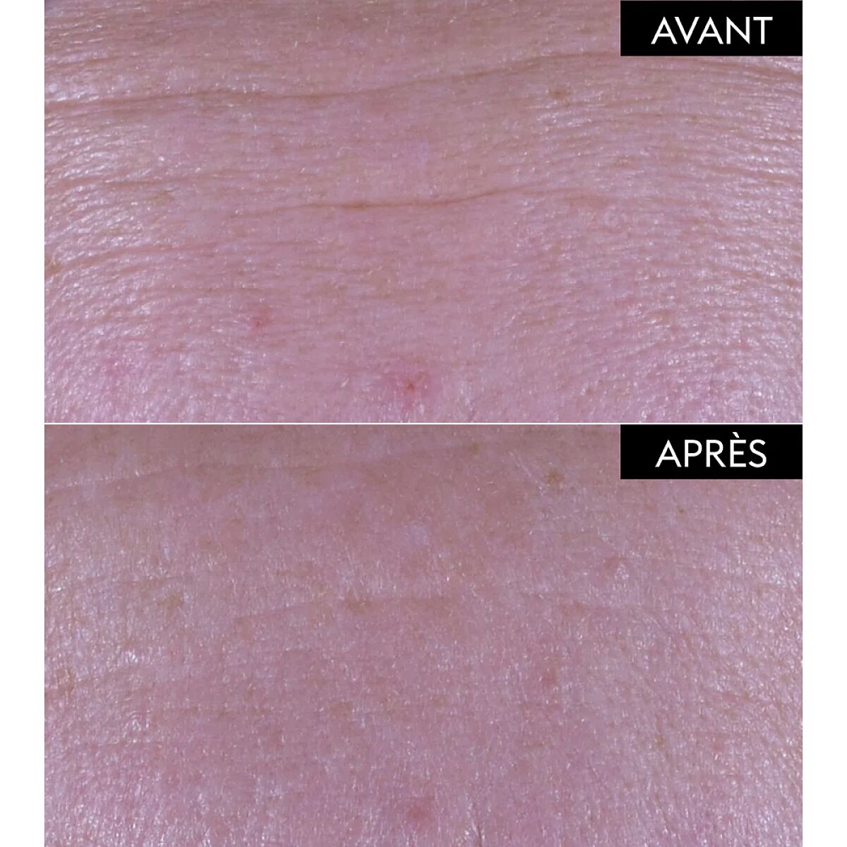 Advanced Plumping Serum