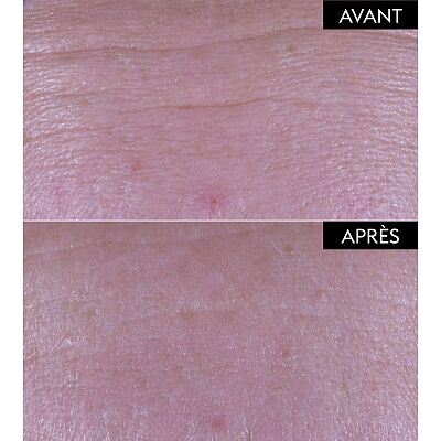 Advanced Plumping Serum